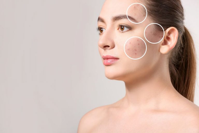 Nouvaderm Laser Treatmentenerative Aesthetics, Dr Nails Goldenberg, Mason, ohio