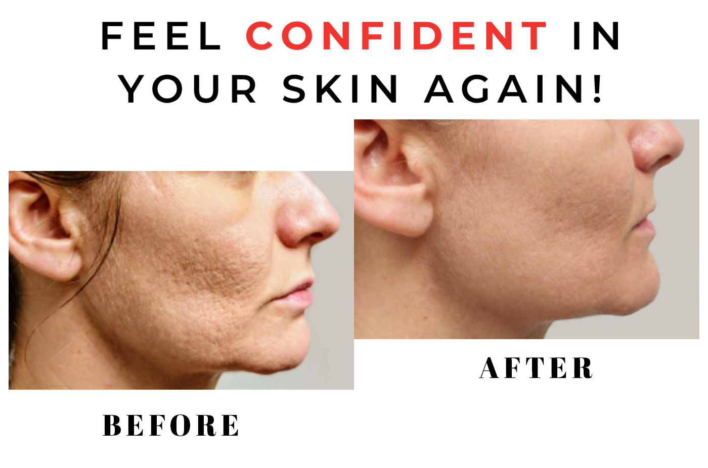 before after 4 scarlet pro Regenerative Aesthetics DR Naila Goldenberg