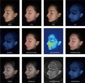 Professional Skin Analyzer images Regenerative Aesthetics, Mason, Ohio